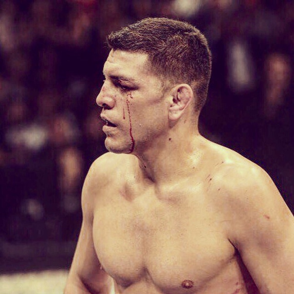 stripchat nick diaz